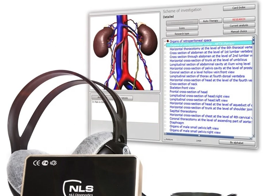 Biorezonanciás vizsgálat