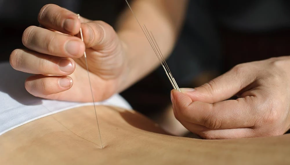 Gyógyítási technika